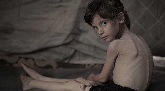 How Israel caused a famine in Gaza