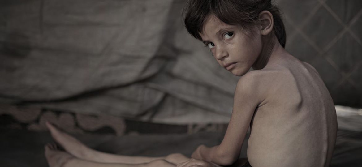 How Israel caused a famine in Gaza