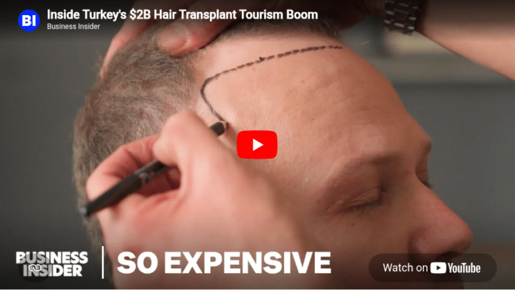 Inside Turkey's $2B hair transplant tourism boom