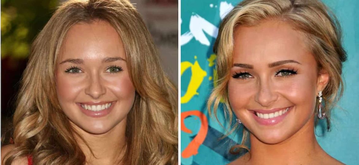 American Actress Hayden Panettiere Dies at 36